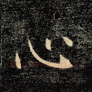 心
